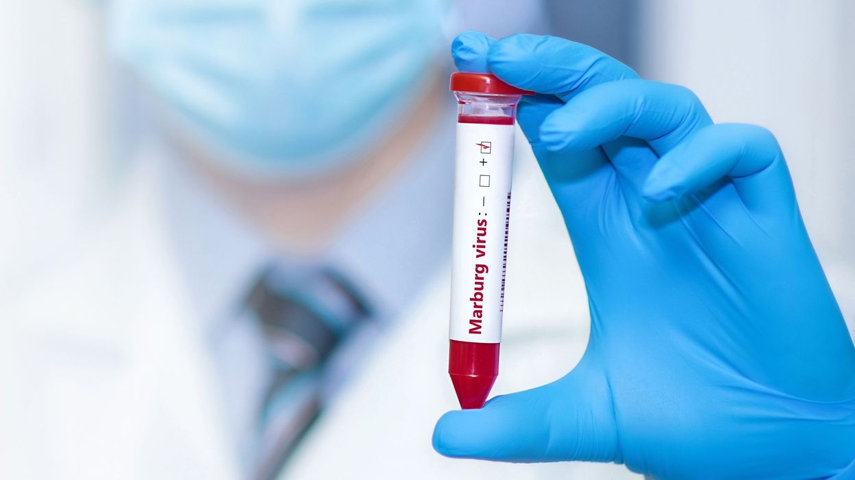 Virus de Marburg en Guinée équatoriale : 20 morts, selon un nouveau bilan de l’OMS