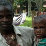 Equateur : environ 241 décès sur 3 000 cas de Monkey pox notifiés en 4 mois