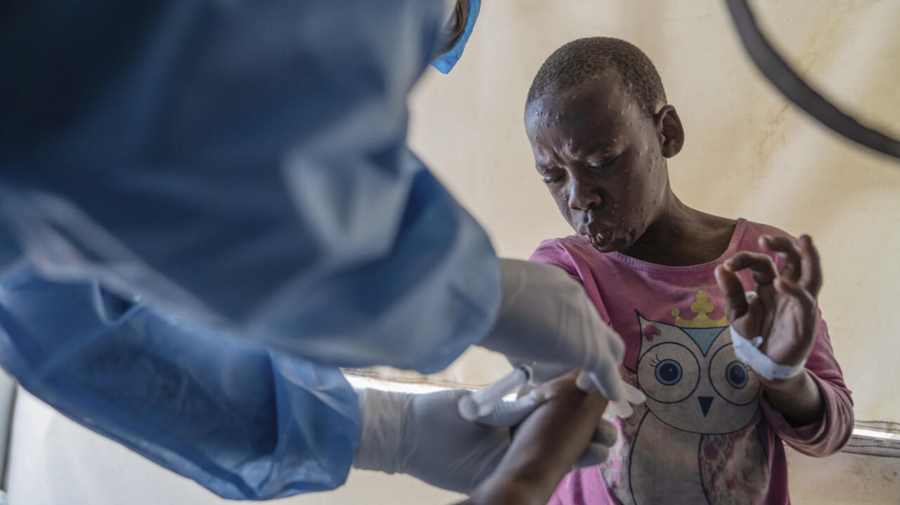 Mpox en RDC: «Nous appelons toute la population africaine concernée à se faire vacciner»